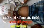 Innocent fired hot bars in bhilwara