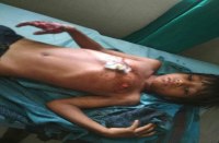 mobile, mobile bettery, bettery blast, district hospital, patrika news, patrika bhopal, bhopal mp, bhopal news, sehore hospital, 