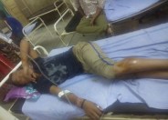 Injured minor