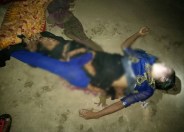 Dead body