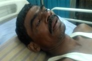 एक आरक्षक के सिर पर पटका लोहे का बैंच, हालत गंभीर
