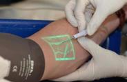 Vein Viewer Flex
