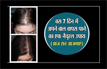 बस 7 दिन में अपने बाल वापस लाने का नेचुरल उपाय, आज रात अपनाएं