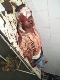 Death during treatment of injured