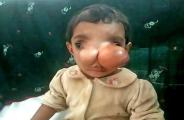 Elephant nose 