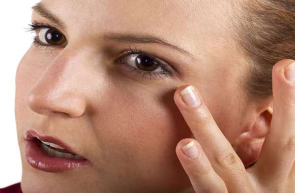 dark circles of eyes