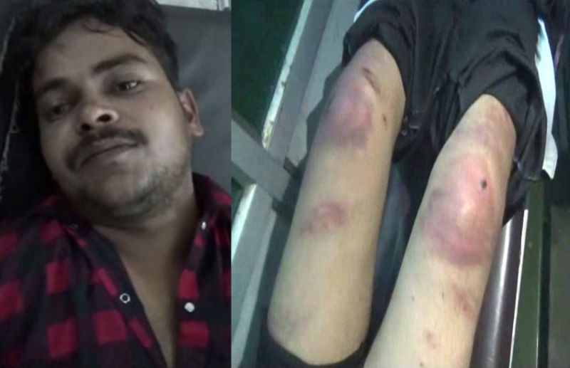 UP police torture