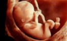 Big news- not made brain of two children in the womb