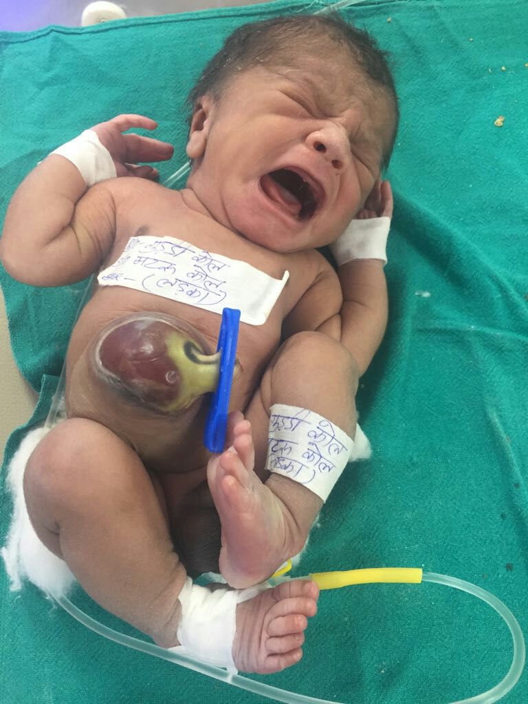 Not made stomach wall, gutted intestine