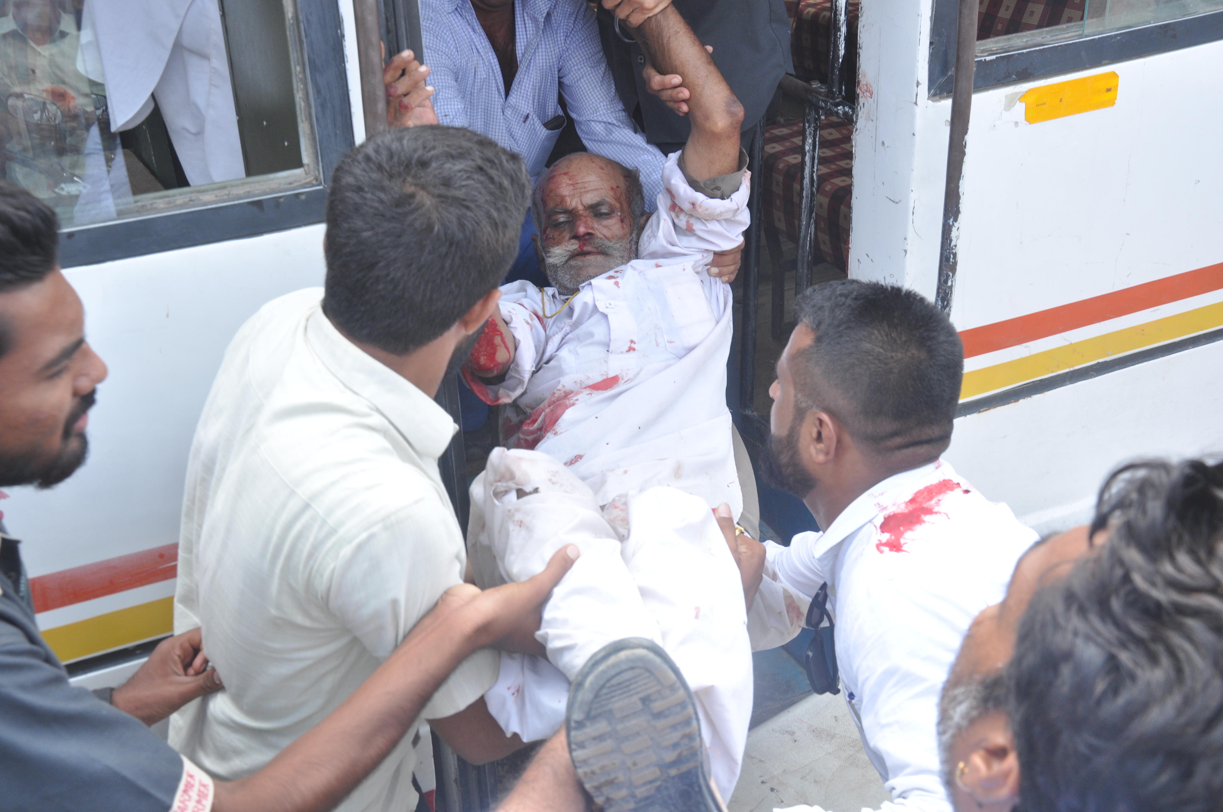 Uncontrollable private bus flip, 18 injured passengers