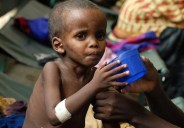 malnutrition