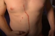 stomach