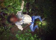 Dead body