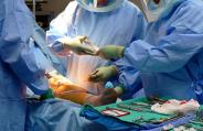 Operation