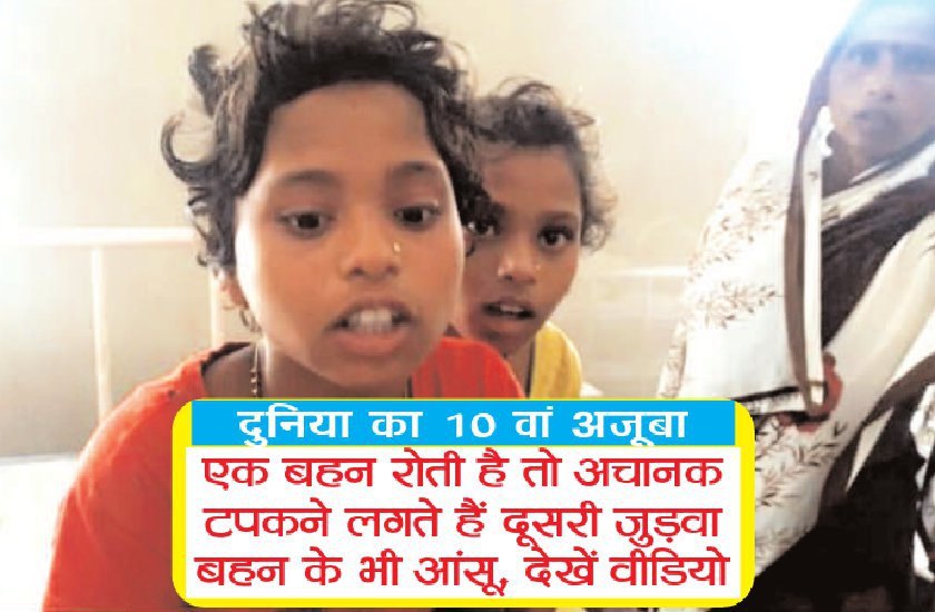 amazing true story of two twins sisters