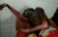 Wife Burned Alive