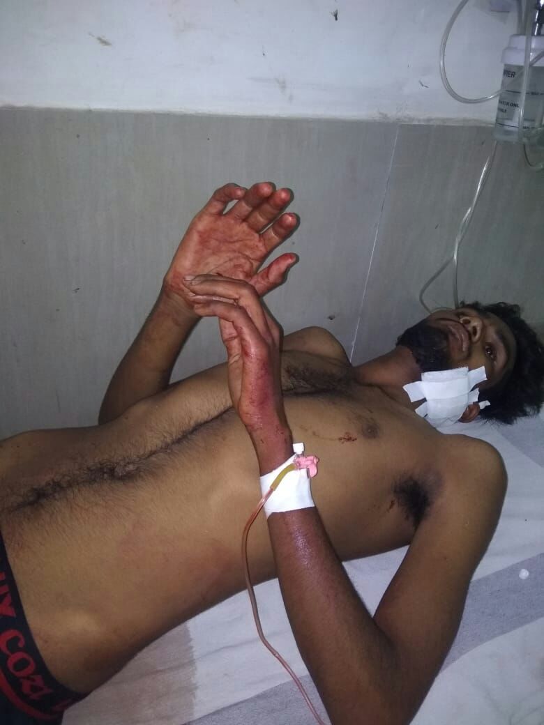 घायल को मेडिकल कॉलेज अस्पताल में कराया गया भर्ती