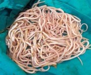 worm