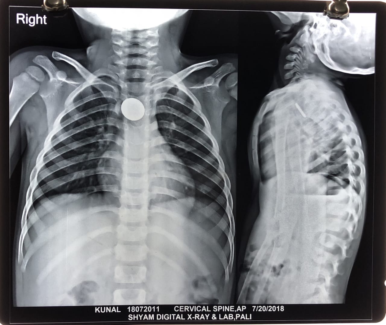 6-year-old boy leaves cell of remote