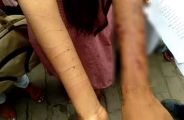 rape victim