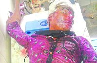 Bike rider death by car collision