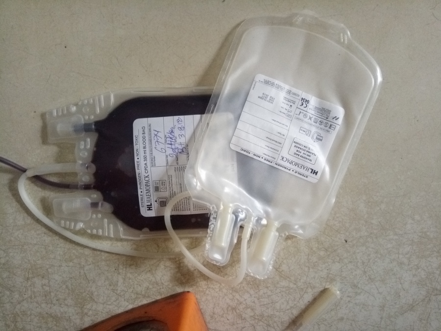 With this procedure blood will be of three types