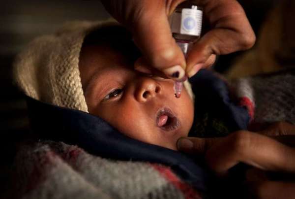 polio 
