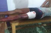 Breaking : रोपा लगाने गए तीन ग्रामीणों पर जंगली सूअरों का हमला, अस्पताल दाखिल