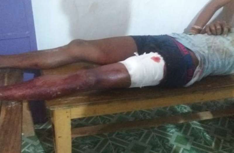 Breaking : रोपा लगाने गए तीन ग्रामीणों पर जंगली सूअरों का हमला, अस्पताल दाखिल