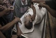 Dead body