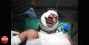bear attack on two people ,badly injured and hospitalised