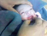 5 teeth baby