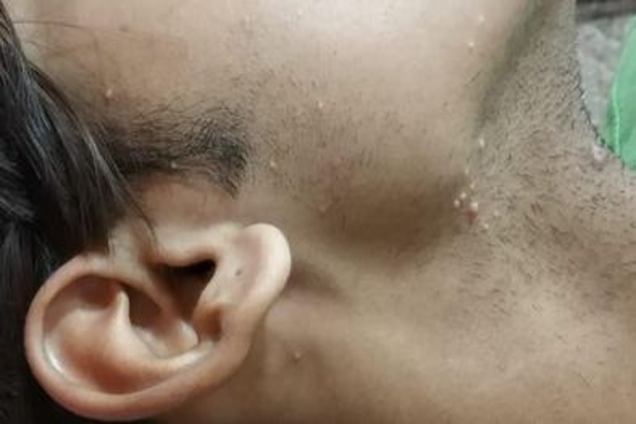 skin specialists in jodhpur
