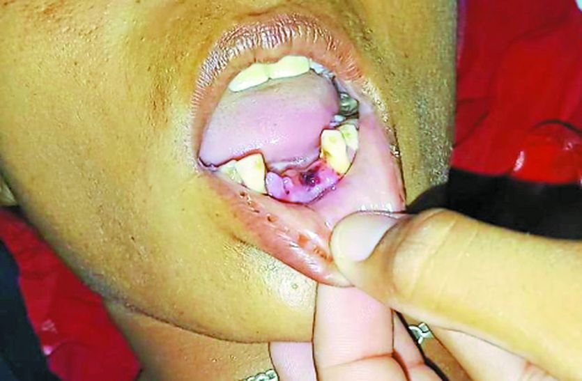 Rajasthan Woman domestic violence victim