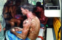 इंडक्शन फर्निश लीक होने से पांच ठेका श्रमिक झुलसे, दो की हालत गंभीर