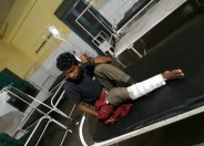 Injured young man
