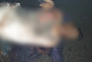 Dead body