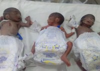 3 children birth together