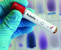 Baby girl died due to vaccination of rubella