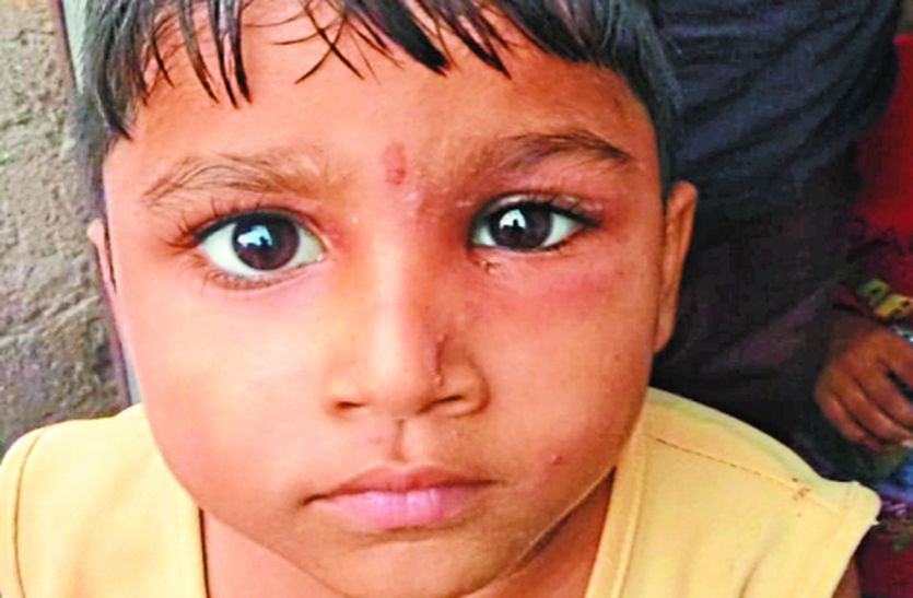 Expiry date medicine reaction in Malsisar Jhunjhunu