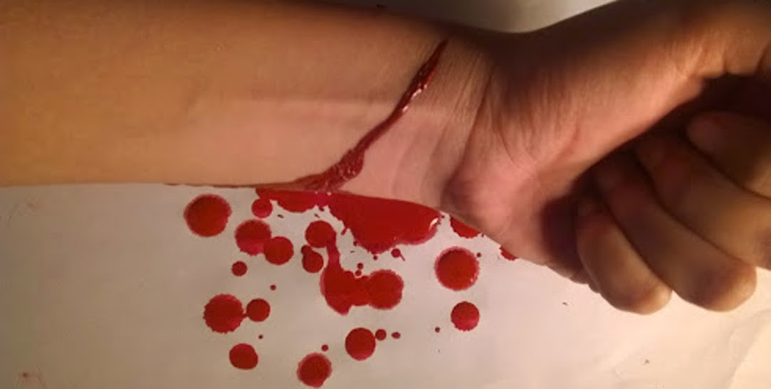 girl cut her wrist for wedding to boyfriend