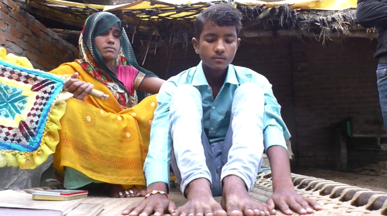 24 fingers boy sacrifice due to superstition in Barabanki
