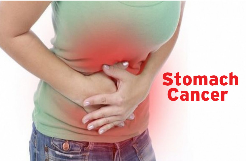 Stomach Cancer 