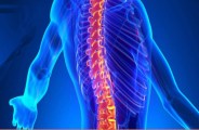 spinal stroke
