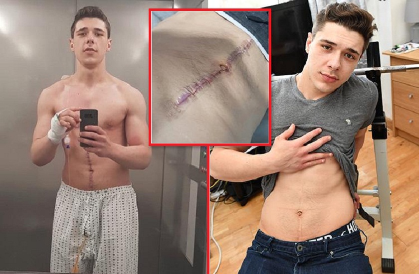 truck ran over him six pack abs saved life of this man