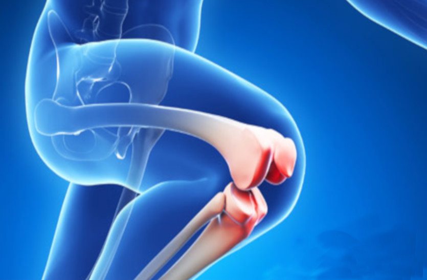 joint Replacement 