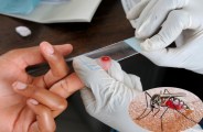 Malaria