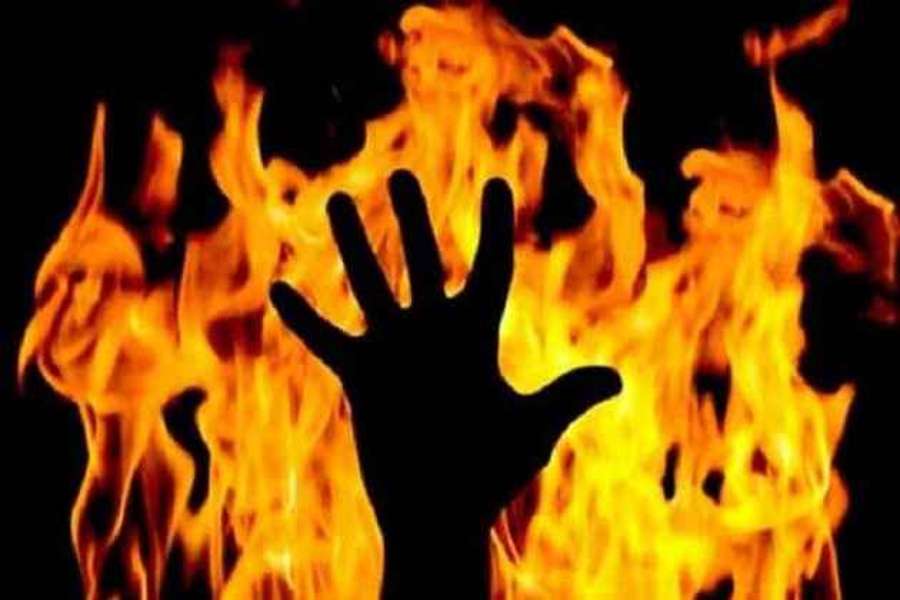 woman burnt case