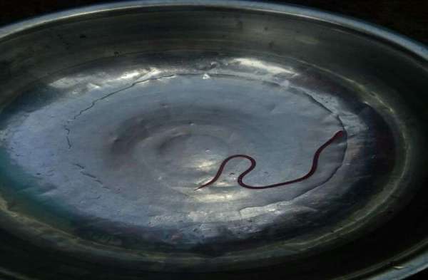 bloodsucker in nagar nigam water