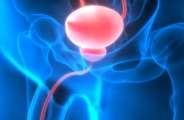 Prostate Cancer